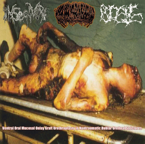 Pyosis : Ventral Oral Mucosal Onlay Urethroplasty on Nontraumatic Bulbar Urethral Structures